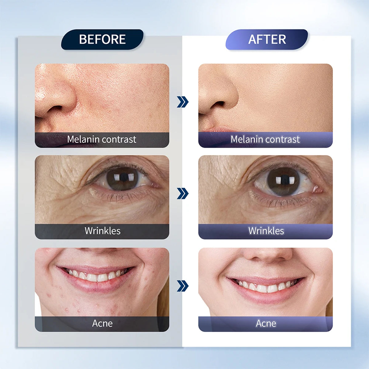 CanbiMart LED Therapy with Nano Spray Skincare