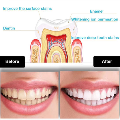 LumiMouni LED Teeth Whitening Kit – 16 High-Power LEDs & 35% CP Gel