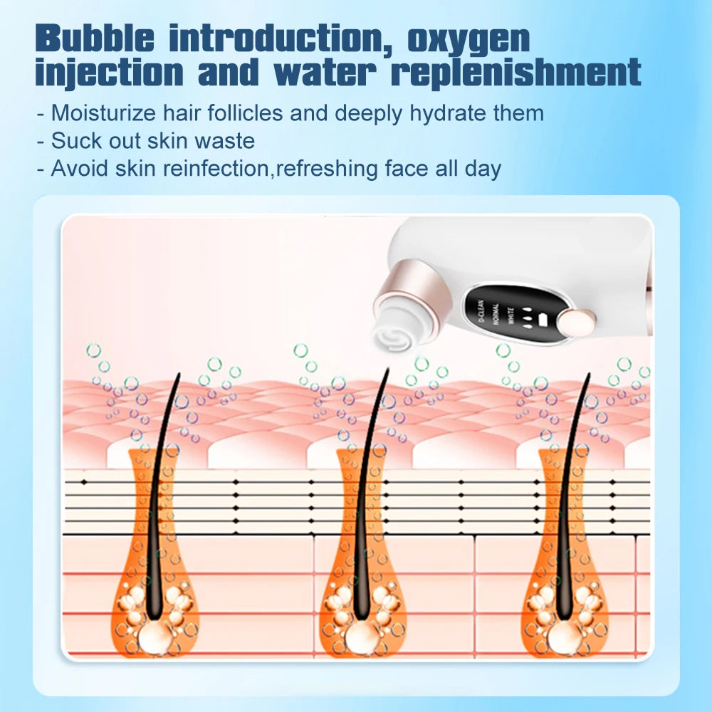 PurePreti Vacuum Pore Cleaner and Blackhead Remover