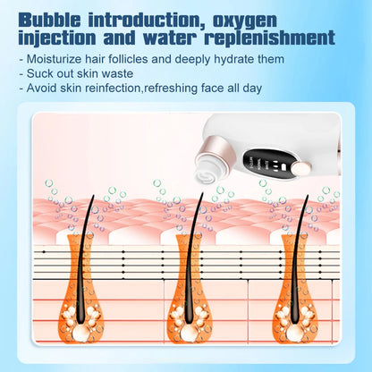 PurePreti Vacuum Pore Cleaner and Blackhead Remover