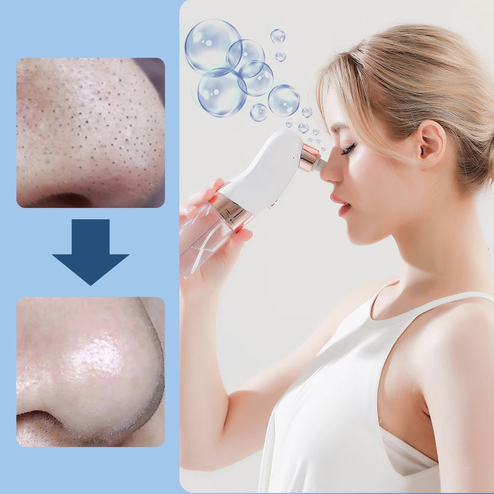 PurePreti Vacuum Pore Cleaner and Blackhead Remover