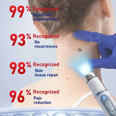 TalfMous Blue LED Light Therapy Wart Care Device