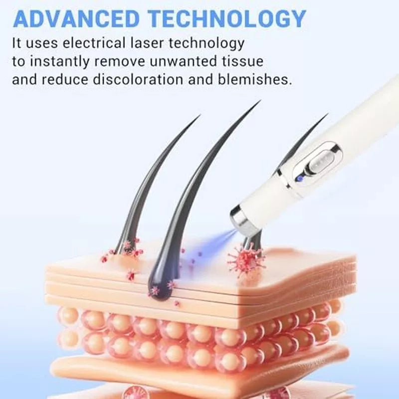 TalfMous Blue LED Light Therapy Wart Care Device