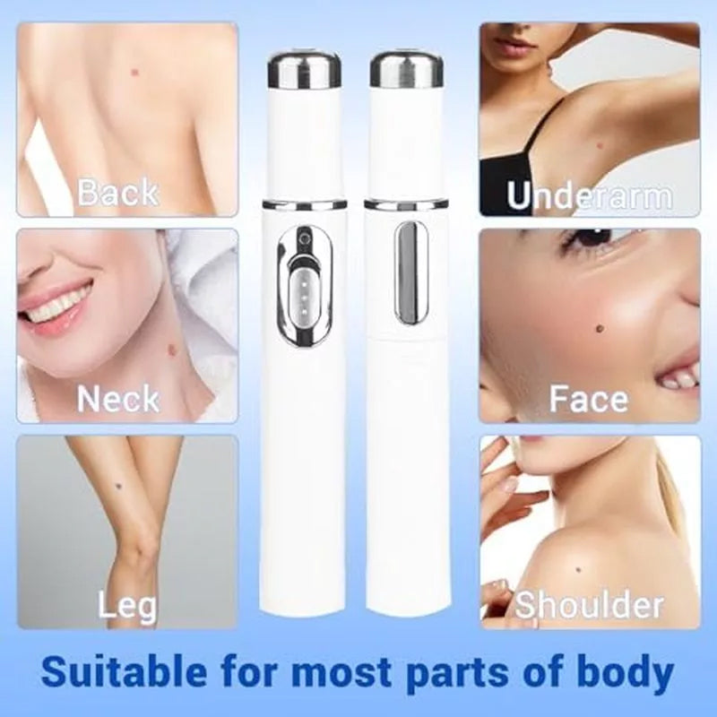 TalfMous Blue LED Light Therapy Wart Care Device