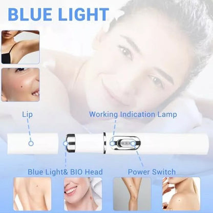 TalfMous Blue LED Light Therapy Wart Care Device
